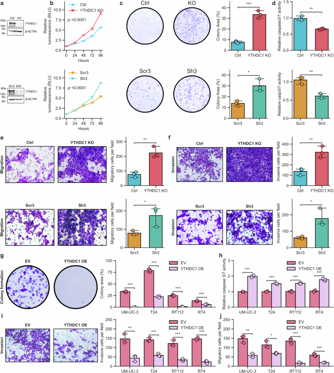 Fig. 2: Cancer-promoting effects of YTHDC1 depletion in urothelial cells.