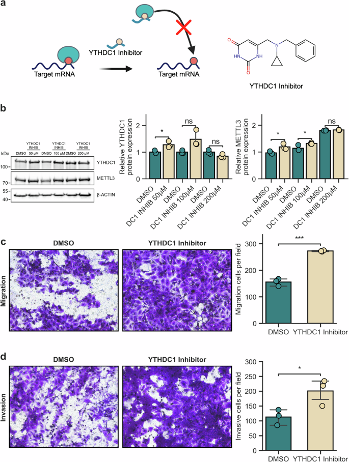 Fig. 3: Loss of the m6A reading function of YTHDC1 enhances urothelial cell migration and invasion.