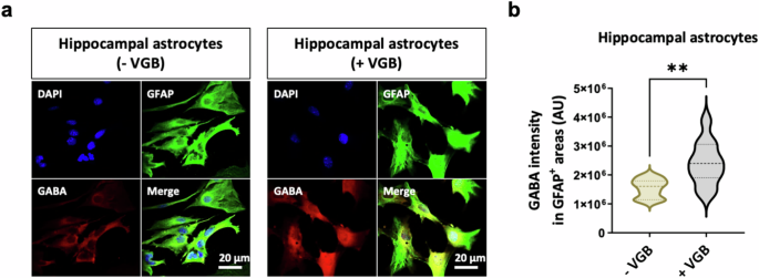 Fig. 2: Astrocytic GABA-T is critical for GABA clearance.