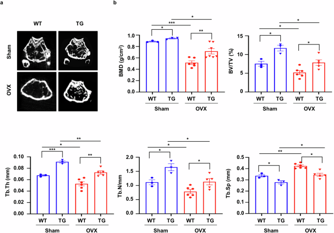 Fig. 1: sLZIP promotes bone formation and inhibits bone mass reduction in osteoporosis.