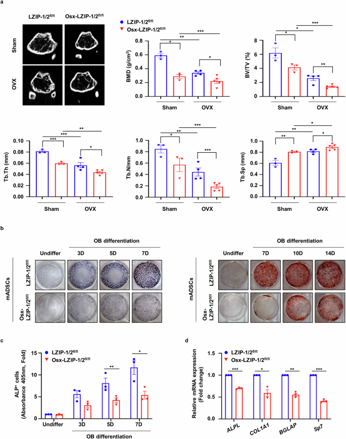 Fig. 2: Deletion of sLZIP reduces bone mass and impedes osteoporosis recovery.
