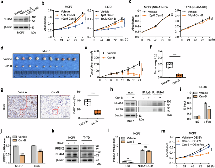 Fig. 7: NR4A1 agonist represses the transcriptional activity of c-Fos.