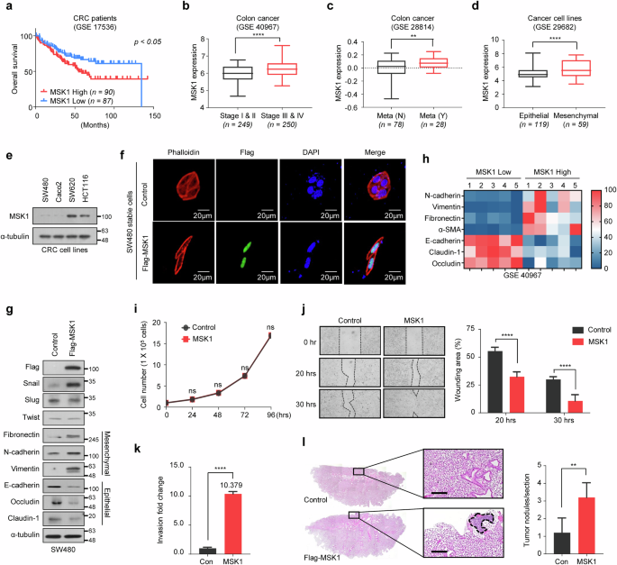 Fig. 1: MSK1 promotes CRC cell metastasis by inducing the EMT process.