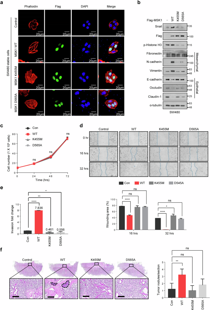 Fig. 4: MSK1 kinase activity is essential to promote CRC cell metastasis.