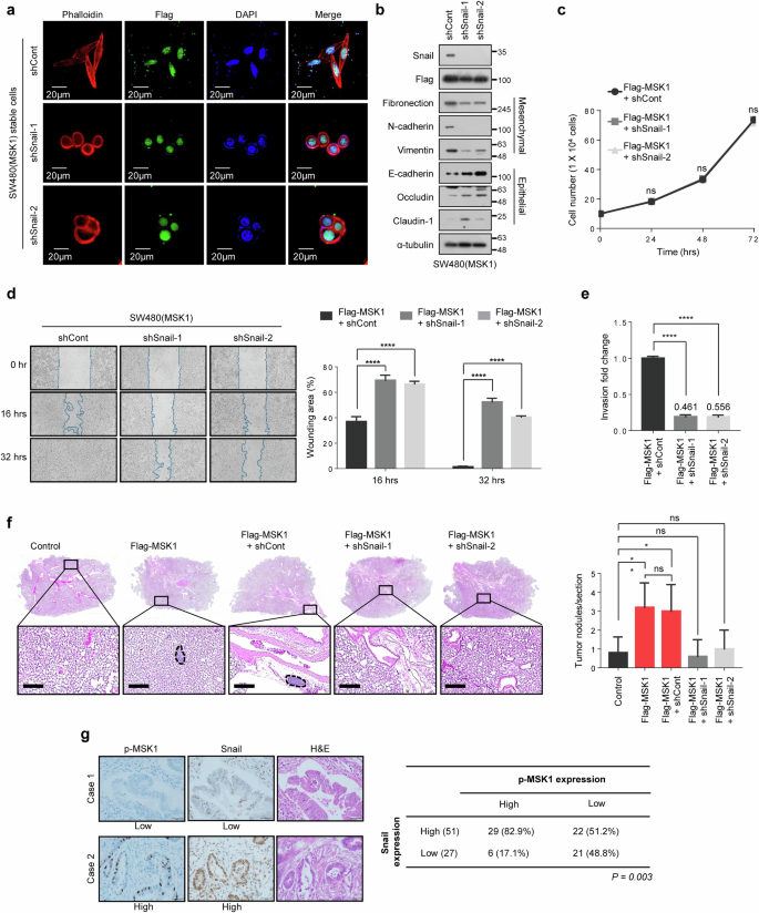 Fig. 5: Snail is essential for MSK1-induced EMT and an increase in CRC cell metastatic ability.