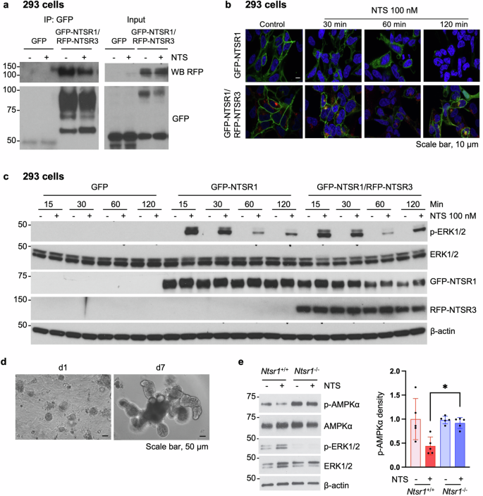 Fig. 1: NTSR1, which forms a complex with NTSR3, mediates AMPK activity.