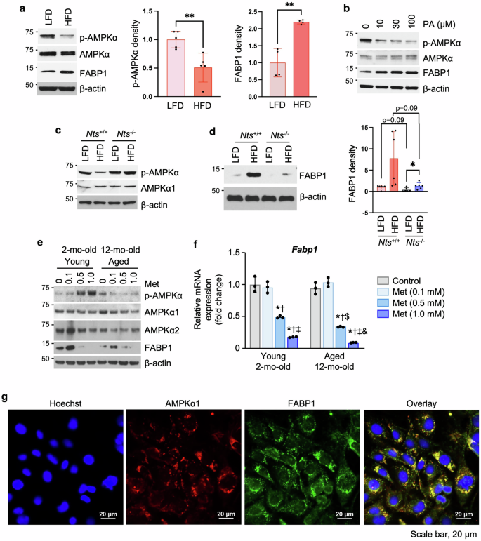 Fig. 5: AMPK activity is correlated with FABP1 expression.