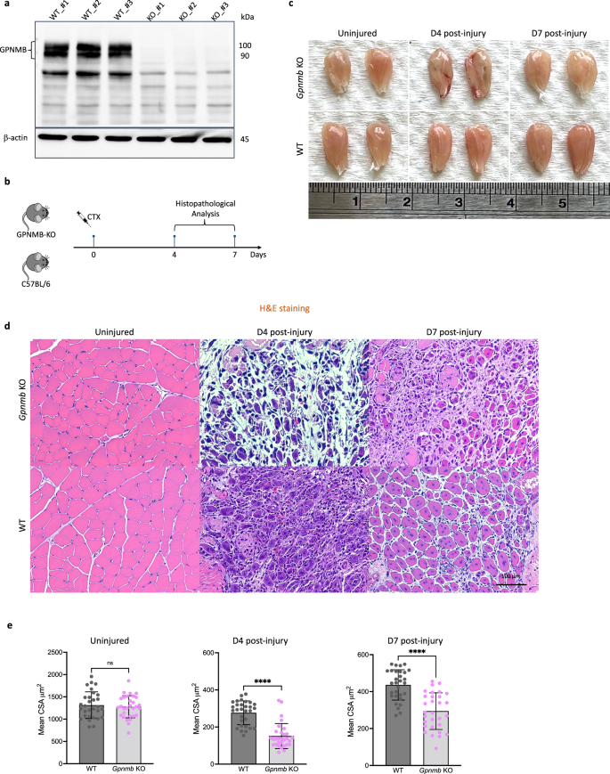 Fig. 4: Impaired muscle regeneration in GPNMB-KO mice after CTX injury.