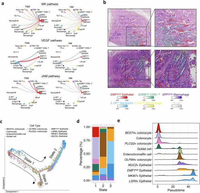 Fig. 5: Pathway and spatial transcriptomic analyses.