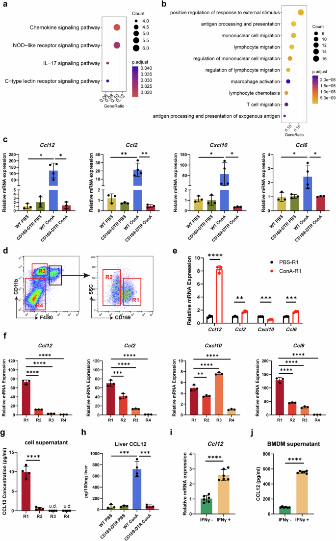 Fig. 6: Selective expression of CCL12 in CD169+ macrophages in AIH.