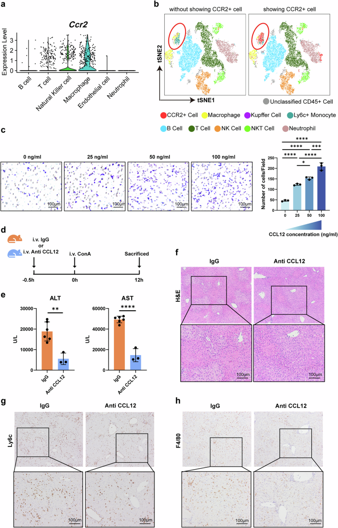 Fig. 7: CCL12 recruits monocytes and macrophages, and neutralizing CCL12 improves AIH.