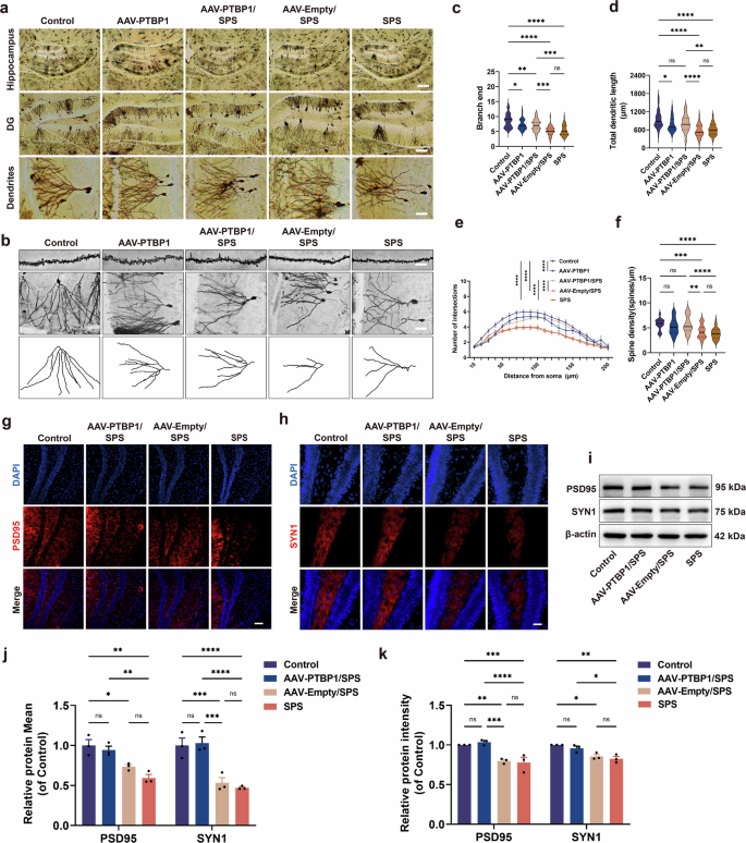 Fig. 5: The effect of PTBP1 KD on synaptic plasticity in hippocampal neurons of normal and PTSD mice.