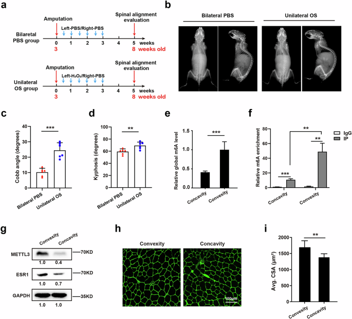 Fig. 4: Unilateral oxidative stress of paraspinal muscle leads to scoliosis through the ROS–Mettl3–Esr1 axis.