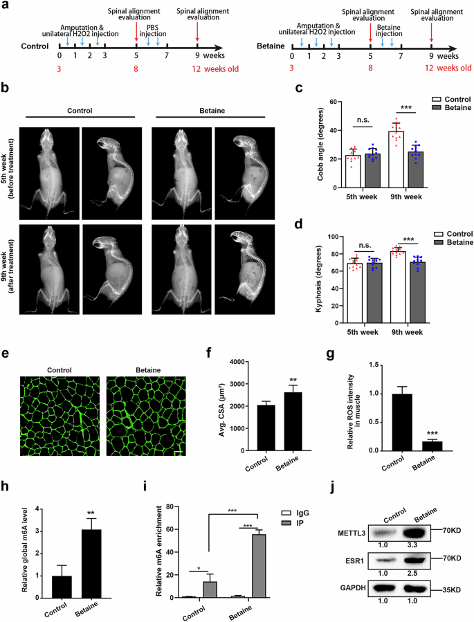 Fig. 6: Betaine alleviates the progression of scoliosis in vivo through the ROS–Mettl3–Esr1 axis.