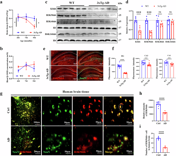 Fig. 1: Histone β-hydroxybutyrylation was significantly decreased in brain tissue of 3xTg-AD mice and patients with AD.