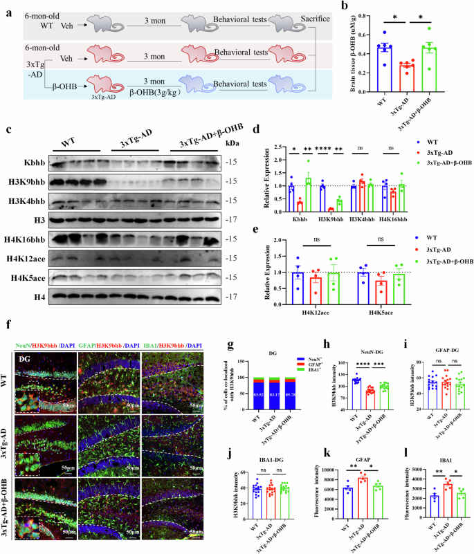Fig. 2: β-OHB supplementation increases H3K9bhb level in the hippocampus of 3xTg-AD mice.
