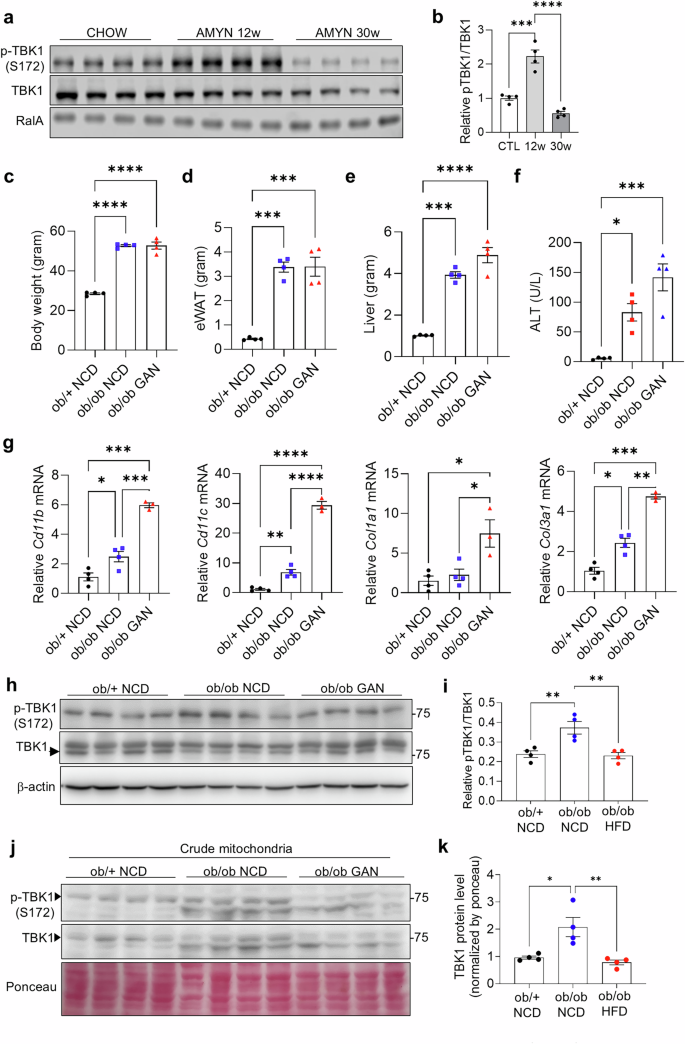 Fig. 5: TBK1 kinase activity is reduced in MASH liver.