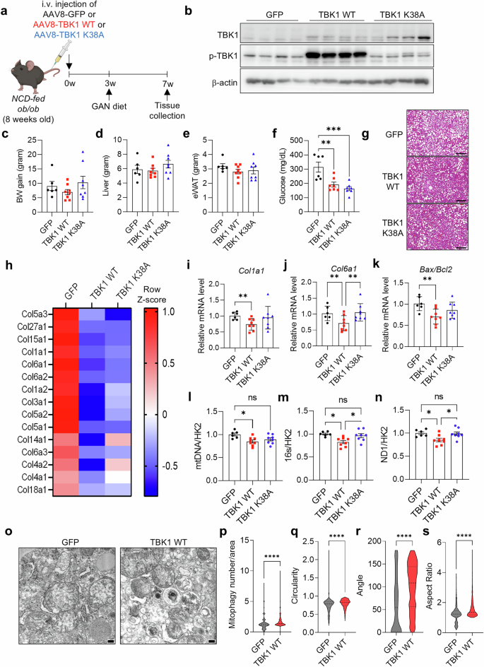 Fig. 6: TBK1 overexpression ameliorates MASH progression in vivo.