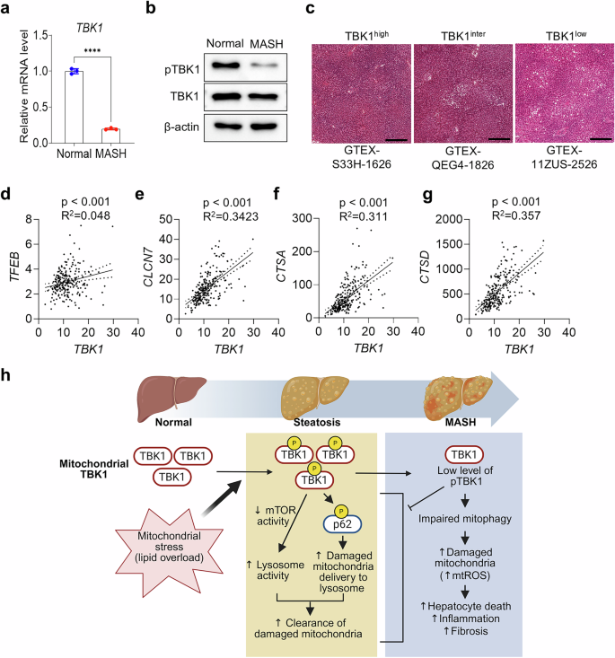 Fig. 7: TBK1 activity shows a negative correlation with MASLD in patients.