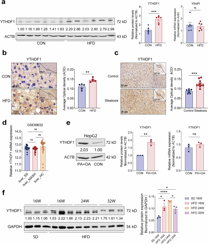 Fig. 1: The protein level of YTHDF1 is elevated in MASLD.