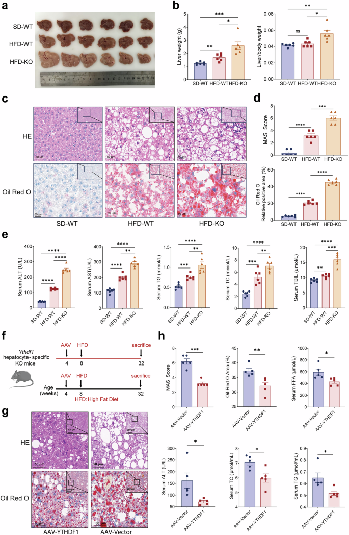 Fig. 2: Liver-specific KO of Ythdf1 predisposes mice to MASLD.