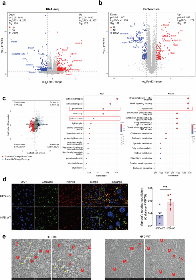 Fig. 3: YTHDF1 loss promotes MASLD through excessive peroxisome activation.