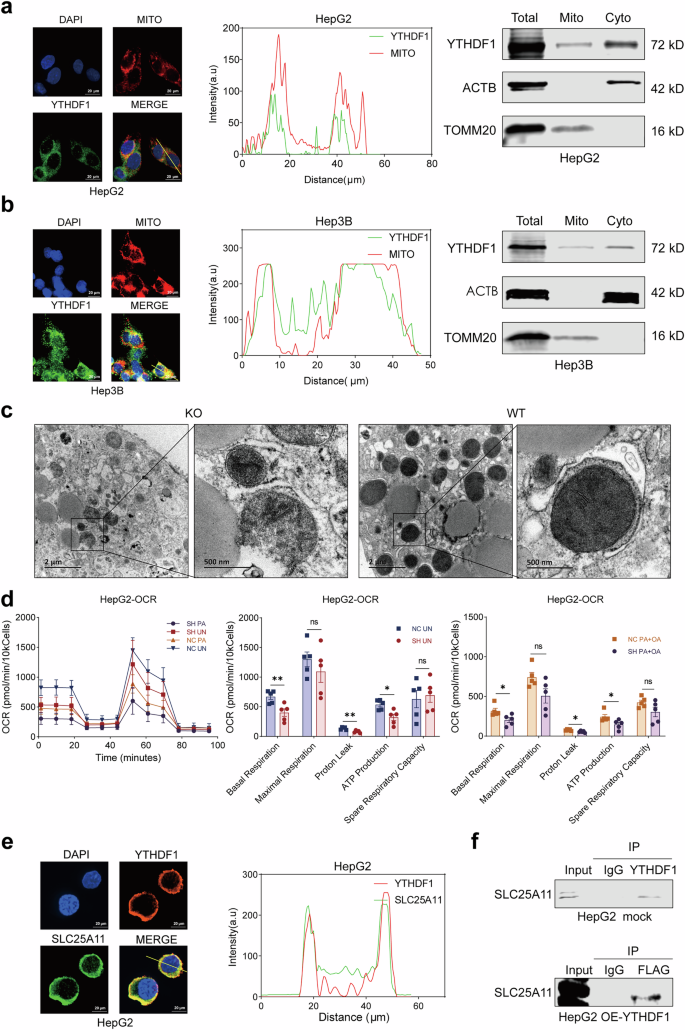Fig. 5: YTHDF1 can be localized in mitochondria and bind to SLC25A11.