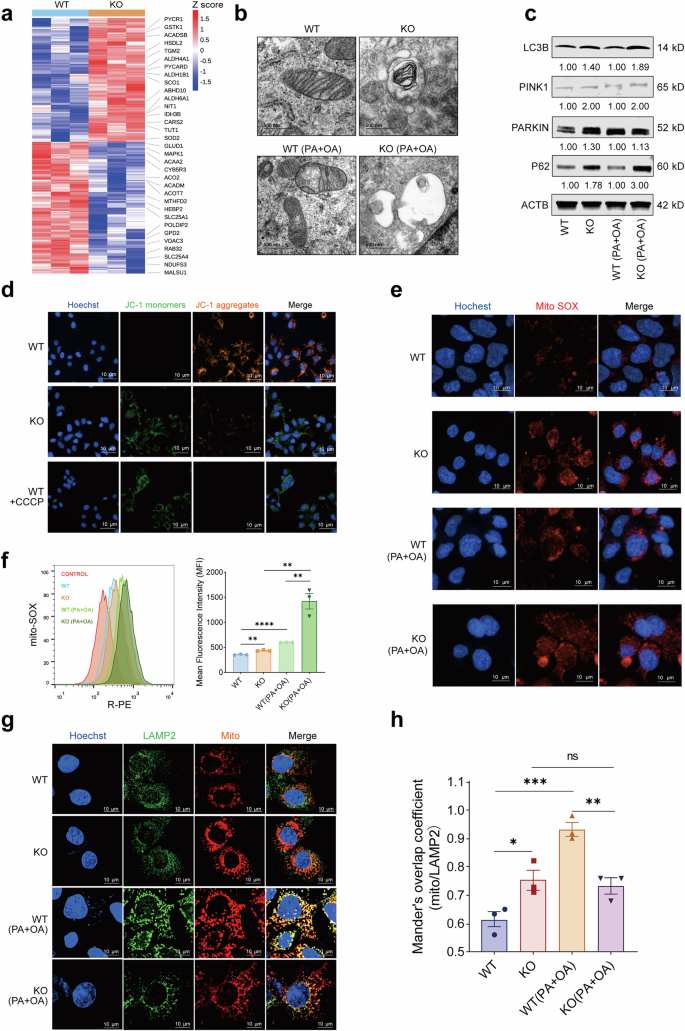 Fig. 6: YTHDF1 deficiency disrupts mitochondrial homeostasis.