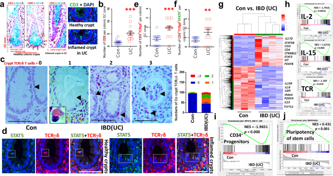 Fig. 1: IBD–UC shows increased colonic crypt TCRγδ T cells and TCR gene signatures, while pluripotency gene signatures of stem cells decrease.