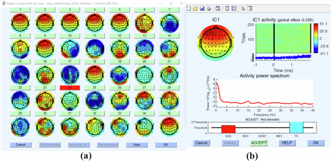 Fig. 6: Independent Component Analysis (ICA) components in EEG preprocessing.
