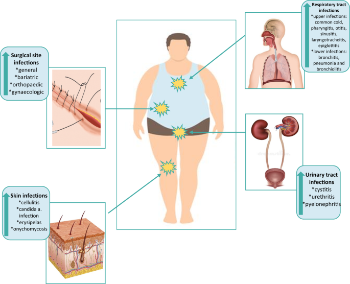 Obesity: World Awareness Of Pathological Conditions