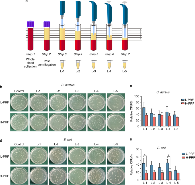 Antibacterial Effects Of Platelet Rich Fibrin Produced By Horizontal Centrifugation International Journal Of Oral Science