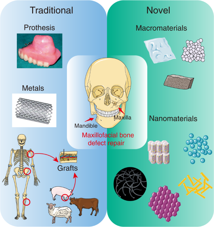 Biomaterial-based strategies for maxillofacial tumour therapy and