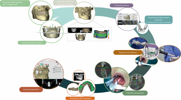robotic surgery research paper figure 5