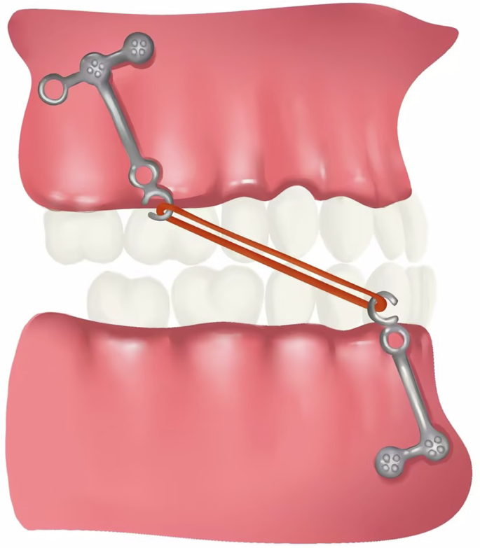 figure 8