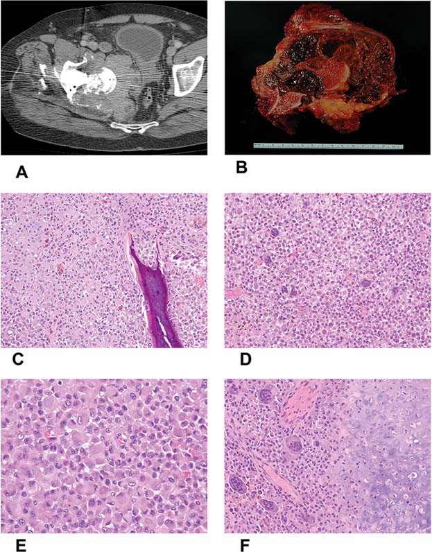 figure b