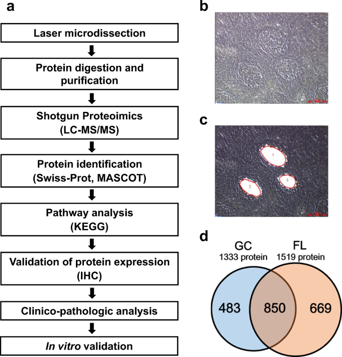 Fatty Acid Beta Oxidation Enzyme Hadha Is A Novel Potential Therapeutic Target In Malignant Lymphoma Laboratory Investigation Fatty Acid Beta Oxidation Enzyme Hadha Is A Novel Potential Therapeutic Target In Malignant Lymphoma Laboratory Investigation