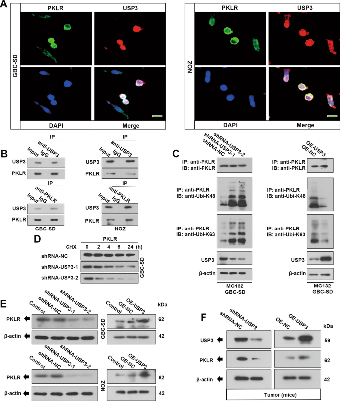 Fig. 4: USP3 regulates the ubiquitination and stability of PKLR in GBC cells.