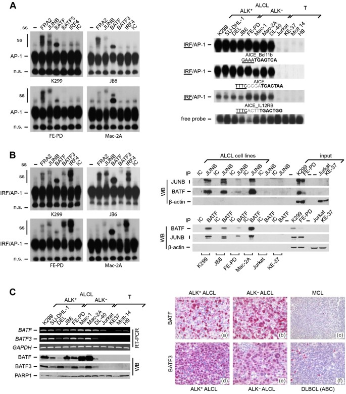 The AP-1-BATF and -BATF3 module is essential for growth, survival and  TH17/ILC3 skewing of anaplastic large cell lymphoma | Leukemia