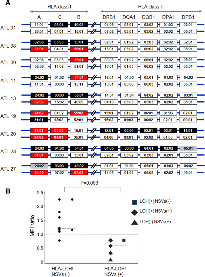 Fig. 1: Overview of the HLA gene alterations and HLA class I expression in ATL cells.
