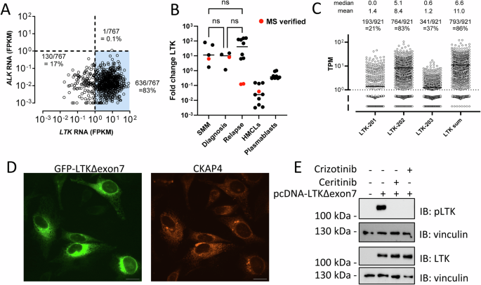 Fig. 1: LTK, but not ALK is expressed in multiple myeloma cells.
