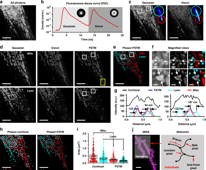 Fig. 2: Phasor-FSTM for two-color super-resolution imaging of a living HeLa cell.