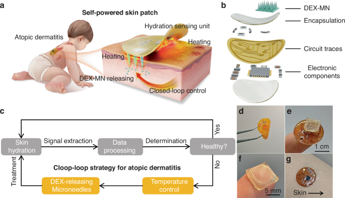 Fig. 1: Design of the self-powered closed-loop skin patch.