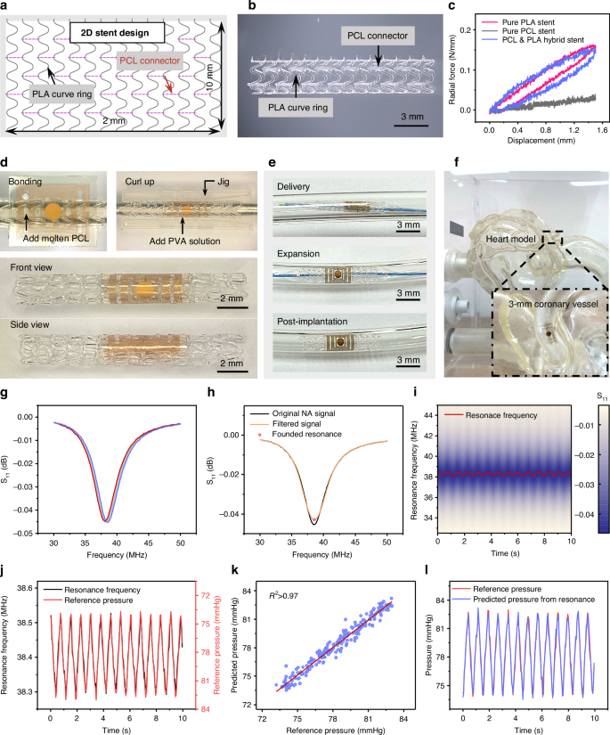Fig. 4: Fabrication, integration, deployment, and functional validation of the smart stent system.