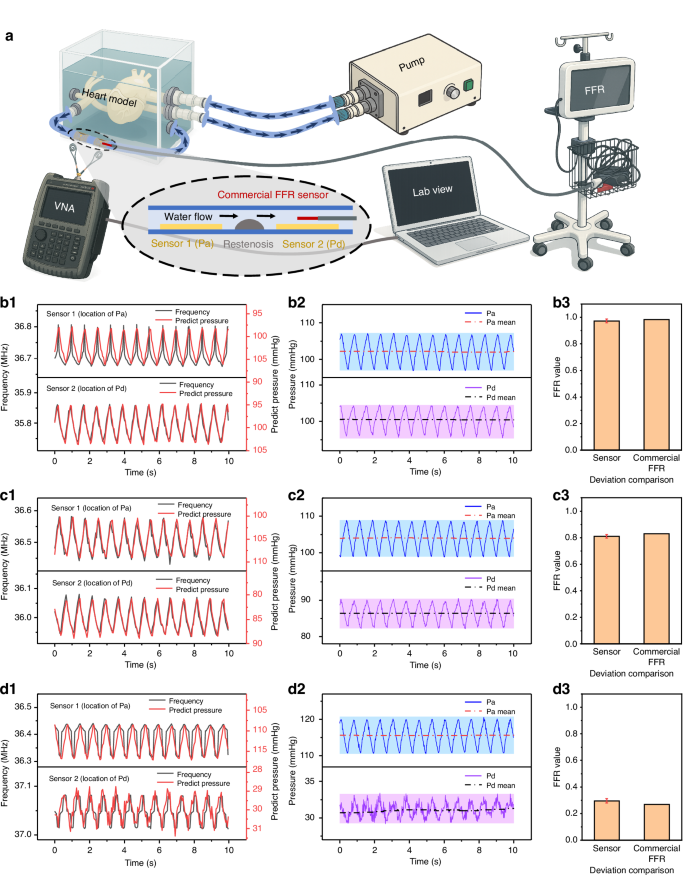 Fig. 5: Evaluation of FFR using the proposed smart stent and comparison with a commercial FFR system.