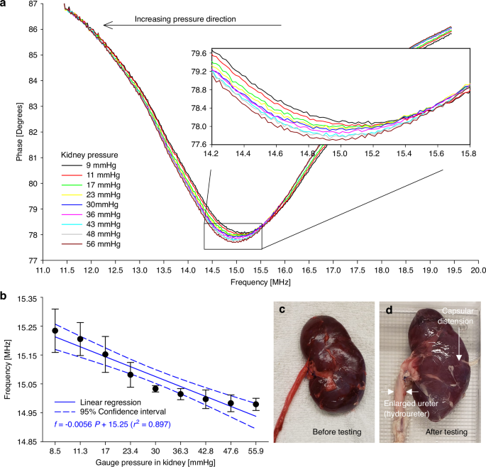 Fig. 6: Ex vivo demonstration of wireless intrarenal pressure sensing using the UroSleeve