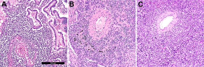 Fig. 1: Morphologic appearances of pulmonary lymphomas.