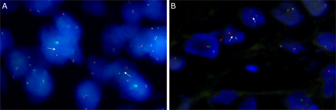 Fig. 3: FISH results.