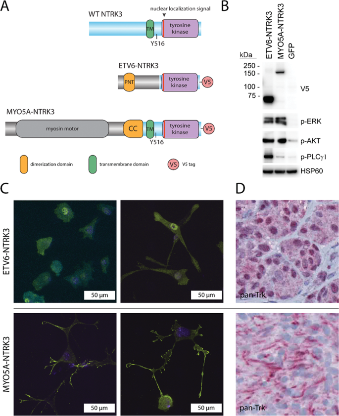 Fig. 6: NTRK3 fusions contain different portions of NTRK3 and have distinct subcellular localizations.