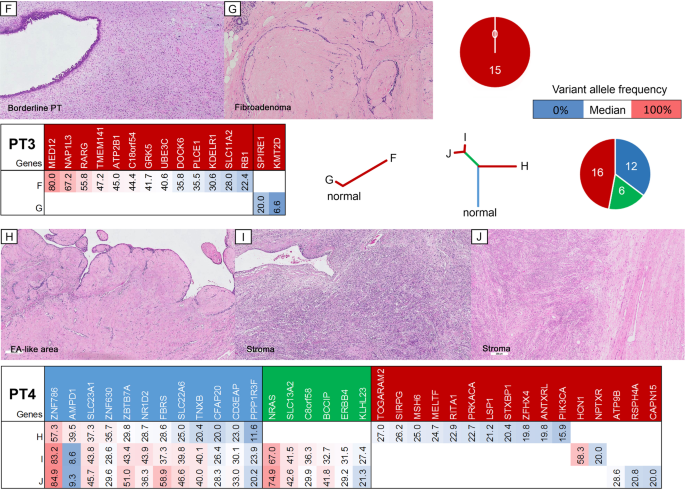 Morphologic And Genetic Heterogeneity In Breast Fibroepithelial Lesions A Comprehensive Mapping Study Modern Pathology